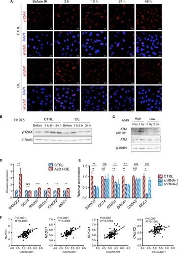 Figure 4 The capacity of DNA damage repair is enhanced by α2δ1.Notes: (A) Immunofluorescence of γH2AX foci in the control and CACNA2D1-overexpressing H1975 cells after 2-Gy radiation (bar=20 µm). (B) Western blot of the γH2AX levels in the control and CACNA2D1-overexpressing H1975 cells after 2-Gy radiation. (C) Western blot analysis of phosphorylated ATM at Ser1981 and total ATM 1 hour after 2-Gy radiation of the sorted α2δ1-high and α2δ1-low A549 cells. (D, E) Relative expression of stemness and DNA damage repair-related genes by quantitative PCR in the control and CACNA2D1-overexpressing H1975 cells (D) and in the control and CACNA2D1-knockdown A549 cells (E). (F) Correlation between CACNA2D1 expression and NANOG, RAD51, BRCA1, or CHEK2 expression by GEO profile analysis in data set GSE4115. *P<0.05, **P<0.01, ***P<0.001.Abbreviations: ATM, ataxia telangiectasia mutated; CACNA2D1, calcium channel subunit α2δ1; CHEK2, checkpoint kinase 2; CTRL, control; GEO, Gene Expression Omnibus; IR, irradiation; MDC1, mediator of DNA damage checkpoint 1; NS, not significant; OE, overexpression; pS1981, phosphorylated serine 1981; γH2AX, phosphorylated histone H2A member X.