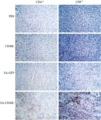 Figure 4. Immunohistochemical analysis for tumor-infiltrating lymphocytes. Bladders were removed from mice 7 days after last intravesical therapy and snap-frozen. Sections of 10 μm were cut and stained with rat-anti-mouse CD4+ or CD8+ antibody. After detection with anti-rat IgG-HRP and development by DAB display liquid kit, sections were counterstained with hematoxylin.