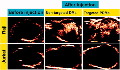 Figure 8. Contrast-enhanced images of targeted PDMs and non-targeted DMs at time to peak in Raji and Jurkat cell-grafted mice. Images of lymphoma before injection A and D, non-targeted DMs B and E, and targeted PDMs C and F at time to peak were acquired in Raji and Jurkat cell-grafted mice. PDM peak intensities and contrast enhancement durations were higher than those of non-targeted DMs in Raji cell-grafted mice, and were higher in Raji as compared to Jurkat cell-grafted mice.