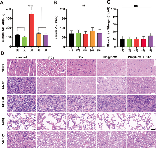 Figure 8 Safety evaluation of PD@Dox. (A-C) CK-MB, ALT and BUN were monitored on day 14 after treatment. (1) control; (2) PDs; (3) free Dox; (4)PD@Dox; (5)PD@Dox+aPD-1. (D) Hematoxylin-eosin staining of heart, liver, lung, spleen and kidney tissues obtained from animals in the different treatment groups (scale bar: 50 μm). ****P<0.0001.