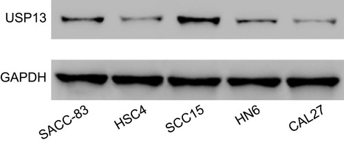 Figure S1 USP13 expression level in five OSCC cell lines was analyzed by western blot.