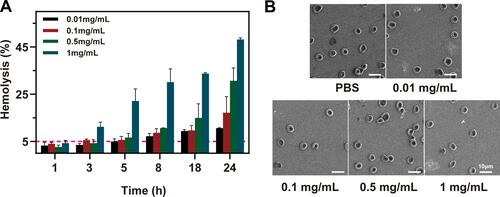 Figure 6 Hemolysis assay (A) and SEM (B) of erythrocytes of CMCh-BAPE-RGD@ICG with different concentrations.