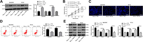 Figure 7 MG132 attenuates Aβ25-35-treated SH-SY5Y and PC12 cell cytotoxicity. SH-SY5Y and PC12 cells were treated with ubiquitination inhibitor MG132 or lysosome inhibitor 3-MA after 25 μmol/L Aβ25-35 treatment. SSTR4 protein level was determined by Western blot analysis (A). Cell viability (B) and apoptosis (C–D) were determined by MTT assay, Hoechst 33258 staining and flow cytometry, respectively. Western blot analysis was performed to determine apoptosis or autophagy-associated protein levels (E). Each symbol represents an individual experiment. In panel A were analyzed with one-way ANOVA and Tukey’s multiple comparison test; and the data in the rest panels were with the t-test. *p < 0.05.