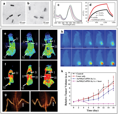 Figure 3. PCE-enhancing copper-doped PDA-coated AuNrs for tumor theragnostics. (a,b) TEM images of AuNrs and AuNr@cupda. (c) UV−vis absorption spectra of AuNrs and AuNR@ CuPDA. (d) Real-time temperature (time constants for heat transfer of AuNrs and AuNr@cupda are τ = 404.4 s and τ = 348.5 s corresponding to PCE values 35.8% and 74.4%, respectively). (e) T1-weighted MRI of nude mice bearing KB tumor without AuNr@cupda treatment. (f) T1-weighted MRI of mice 24 h after injection of AuNr@cupda solution. (g) Cone beam CT images of mice treated with saline (left) and AuNr@cupda (right) 24 h after treatment. (h) Infrared thermal images of mice treated with saline (top) and AuNr@cupda (bottom) under 808-nm laser irradiation. (k) Relative growing trend of tumor volume of each group. Reprinted with permission from [Citation79].