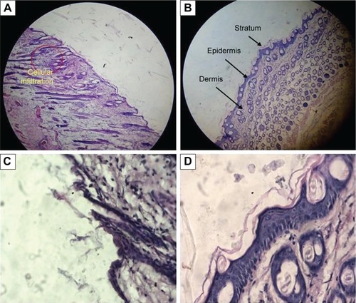 Figure 10 Histological microphotographs of vertical section of mouse skin after hematoxylin and eosin staining.Notes: (A) Positive control treated with formalin at low-power view (×100); (B) negative control treated with saline at low-power view (×100); (C) positive control treated with formalin at high-power view (×400); (D) negative control treated with saline at high-power view (×400).