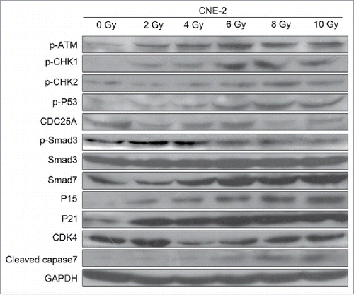 Figure 3. Western blotting analysis. Radiation activated the ATM pathway, increased the expression of Smad7 and inhibited the phosphorylation of Smad3.