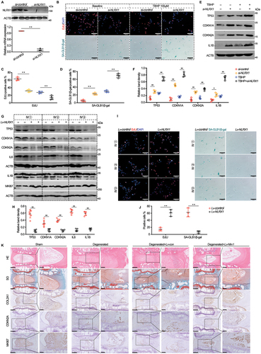 Figure 2. NLRX1 promotes NP cell proliferation, attenuates cell senescence and senescence-associated secretory phenotypes (SASPs) and rescues disc degeneration. Primary human NP cells isolated from NP tissues with different Pfirrmann grades were prepared. (A) knockdown efficiency of NLRX1 in NP cells by siRNA, analyzed with western blotting and RT-qPCR. (B-D) cell proliferation (EdU incorporation) and cell senescence (SA-GLB1/β-gal staining) in primary human NP cells isolated from health NP tissues treated by PBS or TBHP with NLRX1 knockdown or not, scale bar: 100 μm. (E and F) protein expressions of senescence indicators (TP53, CDKN1A, CDKN2A), SASP factors (IL1B) in primary human NP cells isolated from health NP tissues treated by PBS or TBHP with NLRX1 knockdown or not, as determined by western blotting. (G and H) protein expressions of senescence indicators (TP53, CDKN1A, CDKN2A), SASP factors (IL1B) and cell proliferation (MKI67) in primary human NP cells isolated from degenerated NP tissues with NLRX1 overexpression or not, as determined by western blotting. (I and J) cell proliferation (EdU incorporation) and cell senescence (SA-GLB1/β-gal staining) in primary human NP cells isolated from degenerated NP tissues with NLRX1 overexpression or not, scale bar: 100 μm. (K) rat disc degenerative models treated with NLRX1 overexpression and histologic analysis, upper panel: HE and so staining, lower panel: immunohistochemical staining of collagen type II, CDKN2A and MKI67, scale bar: 500 μm (left panel), 50 μm (right panel). Data are represented as mean ± SD. *p < 0.05, **p < 0.01.