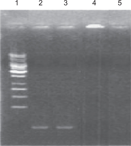 Figure 3 Electrophoresis of simple GAPDH AS-ODN (second track), nonaldehyde Fe3O4-dextran-anti-β-HCG-GAPDH AS-ODN (third track), aldehyde Fe3O4-dextran-anti-β-HCG-GAPDH AS-ODN (fourth track), and Fe3O4-dextran-anti-β-HCG nanoparticles (fifth track).Abbreviations: GAPDH, glyceraldehyde-3-phosphate dehydrogenase; AS-ODN, antisense oligodeoxynucleotides; Fe3O4, magnetic iron oxide; HCG, human chorionic gonadotropin.