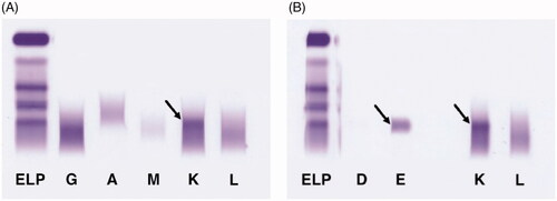 Figure 2. Serum immunofixation. (A) Serum immunofixation against immunoglobulin heavy chains gamma, alpha, mu and immunoglobulin light chains kappa and lambda, showing a band positive for kappa chains (arrow). (B) Serum immunofixation including antisera directed against immunoglobulin heavy chains delta and epsilon. The pattern corresponds to an IgE kappa monoclonal protein (arrows). ELP: serum protein electrophoresis; G: Ig heavy chain gamma; A: Ig heavy chain alpha; M: Ig heavy chain mu; D: Ig heavy chain delta; E: Ig heavy chain epsilon; K: Ig light chain kappa; L: Ig light chain lambda.