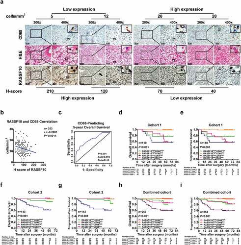 Figure 3. Intratumoral RASSF10 expression is negatively correlated with TAM infiltration and indicative of ccRCC patients’ prognosis. (a), Representative images of H&E and IHC staining of RASSF10 and CD68 in ccRCC tissues from cohort 1 are presented (the different scale bars have been shown on the images). (b), Results of the correlation analysis between the H-scores of RASSF10 and CD68 in the ccRCC samples are shown (n = 253). (c), A time-dependent ROC analysis was employed to detect the optimal H-score cutoff value of CD68 in cohort 1 (n = 110). (d–i), Kaplan-Meier analyses of OS and PFS in ccRCC patients were performed in cohort 1 (n = 110; (d,e)), cohort 2 (n = 143; (f,g)), and the combined cohort (n = 253; (h,i)) (p value: log-rank test). All p values are defined as *p < .05, **p < .01 and ***p < .001