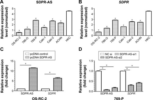 Figure 3 SDPR expression was co-regulated with SDPR-AS overexpression or knockdown in RCC cell lines.