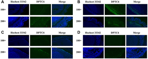 Figure 6 Fluorescence signal distribution on xenograft tumors. DSPE-PEG-TPZ@C6 MNs was administered to B16 (A) and SCL-1 (B) xenograft tumors. DPTC6-containing aqueous solution was administered to B16 (C) or SCL-1 (D) xenograft tumors.