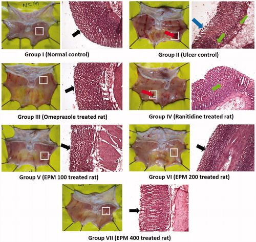 Figure 4. Morphological and histological study of stomach tissues after ulcers induction by absolute ethanol and protection by standard drug omeprazole, ranitidine, and EPM (100, 200, and 400 mg/kg, p.o.). The histopathological sections were stained with hematoxylin and eosin dyes and the photographs were taken with a Nikon digital microscope (Eclipse 200) with 10 × magnification.
