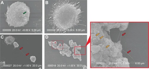 Figure 1 Scanning electron micrographs showing incomplete phagocytosis of MWCNTs by alveolar macrophages.Notes: (A) Nontreated AMs appeared spherical with few filopodia (white arrow) and some membrane ruffling (green arrow). (B) Activation of AMs, with a large increase in numbers of filopodia (white arrows) upon exposure to MWCNT-0.6 μm. (C) Recruitment of AMs to a site where an AM has attempted to phagocytose MWCNT-20 μm, indicated with red arrows. Both exposures were for 24 hours, to 10 μg/mL of MWCNT-0.6 μm or MWCNT-20 μm. (D) Incomplete phagocytosis of MWCNT-20 μm by numerous AMs. The dashed rectangle highlights an area where a number of AMs have attempted and failed to completely engulf the MWCNTs while two more AMs have been recruited (red asterisks). The magnified region again shows protruding MWCNTs (red arrows) but also shows the AM undergoing membrane blebbing (gold arrows) and severe membrane distortion, indicative of cellular distress.Abbreviations: MWCNTs, multiwalled carbon nanotubes; AMs, alveolar macrophages.