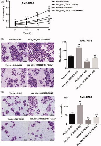 Figure 6. Hsa_circ_0042823 overexpression promoted FOXM1 to enhance AMC-HN-8 cell proliferation, migration and invasion. (A) MTT assay was performed to explore proliferation of the modified AMC-HN-8 cells following hsa_circ_0042823 overexpression combined with FOXM1 knockdown. (B and C) Transwell assay was performed to detect migration and invasion of the AMC-HN-8 cells following hsa_circ_0042823 overexpression combined with FOXM1 knockdown. **p<.01 compared with Vector + Si-NC; ##p<.01 compared with Vector + Si-FOXM1.