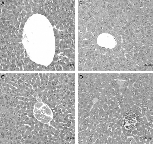 Figure 4.  Histopathology of liver tissue from mice exposed to the fractions of E. axillare at a dose of 200 mg/kg bw after 21 days postoral administration. (A) Control animals, (B) hexane fraction of E. axillare, (C) ethyl acetate fraction of E. axillare, (D) methanol fraction of E. axillare.
