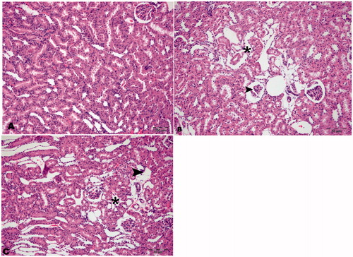 Figure 1. Photomicrographs of rat kidney (H&E, 200×). (A) HRs with normal histological appearance, (B) DRs, and (C) DRs + CN. Degenerative changes in tubuli (*) and glomeruli (arrowhead).