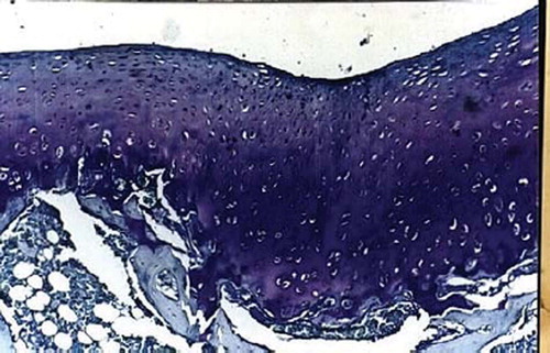 Figures 3. Sagittal sections of cartilage defects transplanted with MSCs derived from periostenum (2) at 12 weeks (toluidine blue staining × 400).
