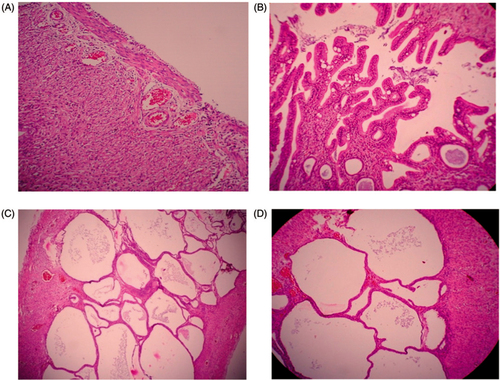 Figure 3. Histological changes in the uterus: (A) normal rat uterus; (B) diseased uterus after PCOS induction; (C) rat uterus treated with quercetin; (D) rat uterus treated with metformin.