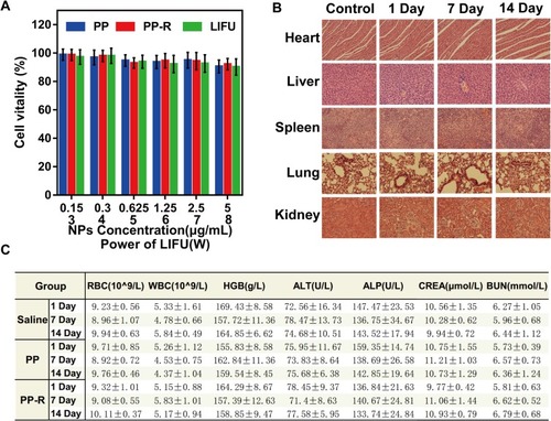 Figure 4 Bio-compatibility and bio-safety of original materials. (A) Cell viability of MGC-803 after incubated with NPs for 24 h and tested by CCK-8 assay. (B) H&E staining of major organs of control group and PP-R group at 1 day, 7 days, and 14 days after being intravenously injected with PP-R (×400). (C) Major indicators of routine blood and blood biochemistry examination of control, PP, and PP-R groups at 1 day, 7 das, and 14 days. (The data were shown as mean±SD, n=3).