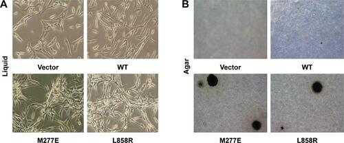 Figure S2 NIH 3T3 cells harboring EGFR M277E and L858R mutations have spindle-like morphologies, increased refractive indices, and multi-layered growth patterns.Notes: Individual colonies formed by NIH 3T3 cells overexpressing vector, EGFR M277E mutant, EGFR L858R mutant, or EGFR WT constructs were grown in liquid cultures (A) and soft agar (B). Representative cells are shown. Original magnifications: ×10 (agar); ×20 (liquid).Abbreviations: EGFR, epidermal growth factor receptor; WT, wild-type.