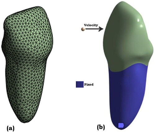 Figure 3. Incisor teeth model (a) meshed model (b) boundary conditions.
