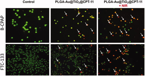 Figure 3. Dual AO/EB fluorescent staining of B-CPAP and FTC-133 thyroid cancer cell lines after treatment with PLGA-Au-TiO2@CPT-11 and PLGA-Au-TiO2@CPT-11 + NIR (IC50 concentration) for 24 h.