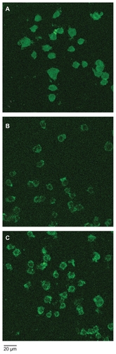 Figure 5 Confocal microscopy images of macrophage–dendrimer hybrids. A) Untreated macrophages incubated with AAF-G4.5-PEG for 10 minutes and fixed immediately (control); B) Macrophage–T-dendrimer hybrids fixed immediately following 10-minute incubation with AAF-G4.5-PEG; C) Macrophage–S-dendrimer hybrids fixed at 14 hours following treatment of sodium cyanoborohydride. Original magnification, ×630.