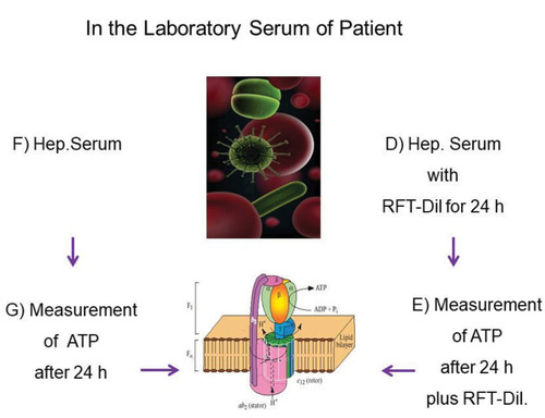 Figure 3 In the Laboratory serum obtained of patient: (D) Exposure of the heparinized whole blood of the patient with the RFT extraction toxin solution (Tox-sol) for 24 hours; (E) measurement of the ATP supply after 24 hours in contaminated blood plus RFT dilution; (F) heparinized whole blood of the patient without the extraction toxin solution (Tox-sol); (G) control measurement of the ATP supply after 24 hours in pure Aqua-Bidest without the extraction toxin solution (Tox-sol).