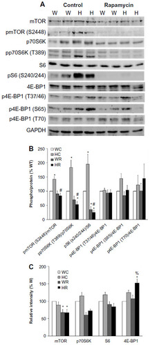 Figure 6 Protein and phosphorylation levels of mTOR and downstream targets of W and Ryr2ADA/ADA mice treated with and without rapamycin.
