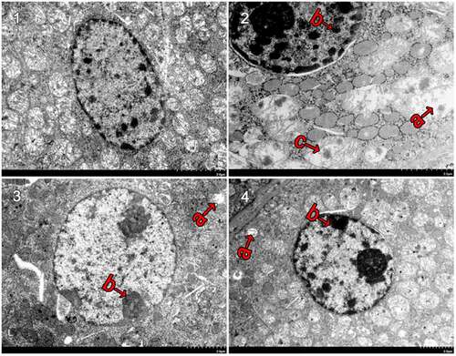 Figure 4. Ultrastructural changes after treatment with fucoxanthin and Shenfukang tablets administration (1) Control group, (2) NCG, (3) PCG, (4) F3, (a) mitochondria damage, (b) karyopyknosis, and (c) mitochondrial rupture. Each group used 20 mice
