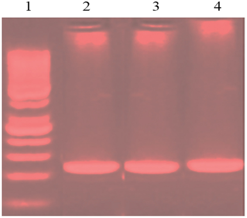 Figure 2. Agarose gel (1.5%) post-electrophoresis displayed 263 bp PCR products in lanes 2, 3, and 4 for KRAS gene mutation linked to (CRC). Lane 1 had a 100 bp DNA ladder.