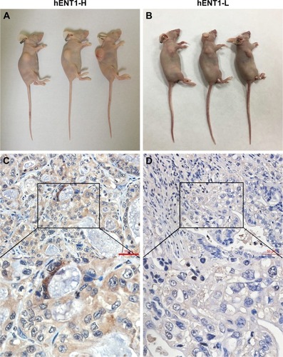 Figure 4 PDX models and IHC of hENT1 in tumor tissues.Notes: Representative images of PDX models in the hENT1-H group (A) and hENT1-L group (B). IHC of hENT1 in hENT1-H (C) and hENT1-L (D) tumor tissues. IHC was used to confirm that the hENT1 expression was higher in the hENT1-H group than in the hENT1-L group.Abbreviations: PDX, patient-derived xenograft; IHC, immunohistochemistry; hENT1-H, high hENT1 expression; hENT1-L, low hENT1 expression.
