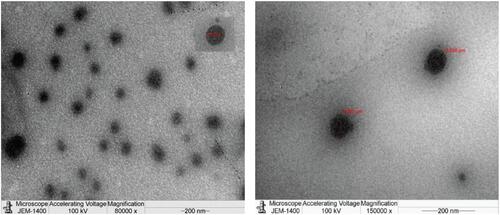 Figure 1 Transmission electron microscopy images of nanoparticles loaded with ciprofloxacin (CLP-NLC) at 8000 and 150,000× magnification power.