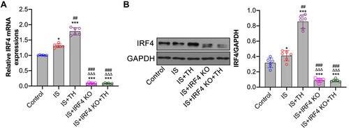 Figure 2 Cerebral IRF4 expressions after IS. RT-PCR (A) and Western-blots (B) were used to measure IRF4 mRNA and protein expressions, respectively. n = 6 in each group. Data were expressed as mean±SD. Comparisons of continuous variables between groups were made by unpaired Student’s t-test. *p < 0.05, ***p < 0.001 vs control group; ##p<0.01, ###p<0.001 vs IS group; ΔΔΔp<0.001 vs IS + TH group.