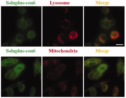 Figure 4. Intracellular trafficking. MDA-MB-231 cells were stained with Lyso-Tracker Red or Mito-Tracker Red for 20 min, after 3-times of washes with PBS, cells were treated with Soluplus-cou6 micelles for 5 min. (A) Colocalization micrographs of micelles with lysosomes. (B) Colocalization micrographs of micelles with mitochondria (Bar = 20 µm).