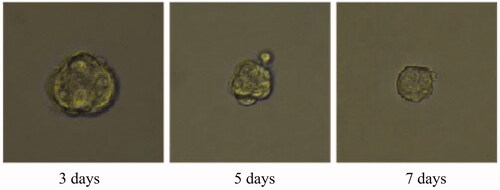 Figure 37. Celastrol treatment group for 3D tumour spheroid. Scale bar = 100 μm.