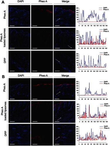 Figure 2 Confocal microscopy to compare skin penetration efficiency of free Pheo A, DPPC liposomes, and DPP transfersomes. The line scan data are shown by the white arrows in the images.Notes: Cross-sections of (A) normal skin; and (B) P. acnes-induced skin were incubated on a Franz diffusion cell (n=3). The blue signal indicates DAPI (nucleus; excitation/emission: 358/461 nm). The red signal indicates Pheo A (excitation/emission: 410 nm/675 nm). Scale bar = 200 μm. Reprinted with permission from Park H, Lee J, Jeong S, et al. Lipase‐sensitive transfersomes based on photosensitizer/polymerizable lipid conjugate for selective antimicrobial photodynamic therapy of acne. Adv Healthc Mater. 2016;5(24):3139–3147.Citation84 Copyright (2016) John Wiley and Sons.Abbreviations: DAPI, 4ʹ,6-diamidino-2-phenylinodle; DPP, DSPE-PEG-Pheo A; DPPC, dipalmitoylphosphatidylcholine; P. acnes, Propionibacterium acnes; Pheo A, pheophorbide A.