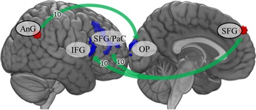 Figure 2. Seed-based functional connectivity during the rumination task. Green arrows indicate stronger connectivity in the group without ACEs. Fisher’s Z is displayed on the arrows. AnG: angular gyrus; IFG: inferior frontal gyrus; OP: occipital pole; PaC: paracingulate cortex; SFG: superior frontal gyrus.