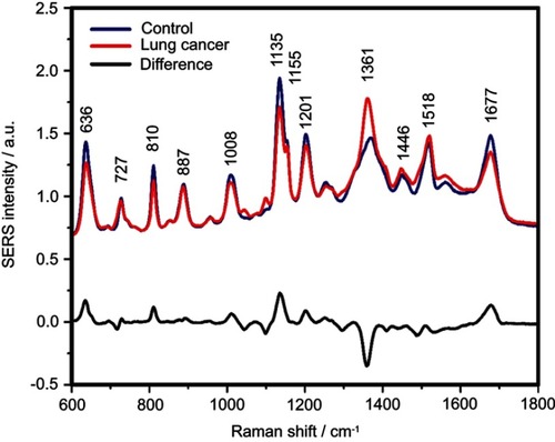 Figure S4 The mean surface-enhanced Raman scattering (SERS) spectra of serum from controls and lung cancer patients and their difference. The SERS spectra were acquired by focusing a 532 nm laser (10 mW) on the samples for 40 s. The SERS spectra were mean normalized and for each spectrum, two measurements were averaged