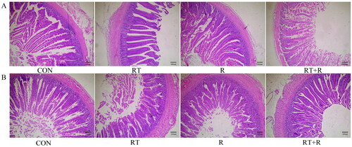 Figure 1. Effects of rutin on the intestinal morphology of laying hens fed a diet containing stored soybean meal. (A) representative images of the jejunum of laying hens, stained with haematoxylin-eosin staining (HE); (B) representative images of the ileum of laying hens, stained with haematoxylin-eosin staining (HE); CON: a basal diet with soybean meal stored in cold storage warehouse; RT: a basal diet with soybean meal stored in room temperature warehouse; SBM: soybean meal; R: rutin.