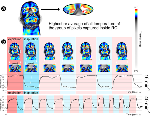 Figure 1. Methodology used to collect clinical parameters through infrared thermography: a – Regions of interest (ROIs) used to collect IRT superficial max face temperature (red triangle: max mid-eye corner temperature between both eyes); b – IRT respiratory rate collection, evidencing the breath waveforms (16 min−1 and 40 min−1), through nostril temperature fluctuation, recorded in real time (blue triangle – in this case minimum temperature being captured at each frame inside the ROI – rectangle).
