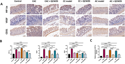Figure 9 QCWZD attenuates angiogenesis in DSS and AOM/DSS mice. (A) HIF-1α, VEGF and CD31 expression in immunohistochemistry; (B) Semi-quantitative immunohistochemical analysis of HIF-1α, VEGF and CD31; (C) The mRNA expression level of HIF-1α in colon. *P < 0.05, **P < 0.01, ***P < 0.001.