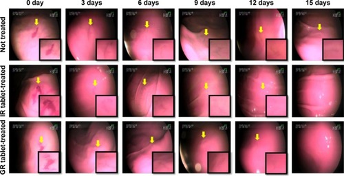 Figure 5 Endoscopic observation of gastritis-like lesions in the stomach of beagle dogs after oral administration of blank tablet (placebo), IR tablet, and GR tablet of DA-9601.