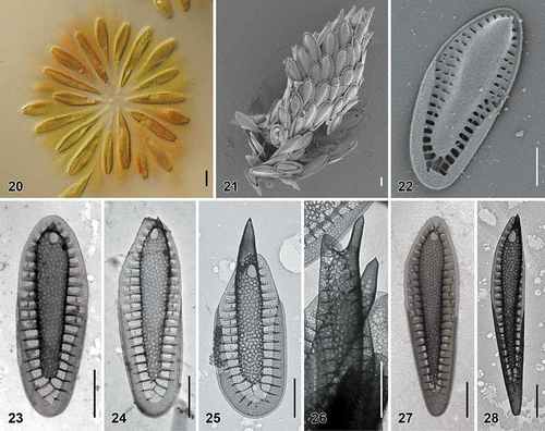 Figs. 20–28. Scale morphology of Synura hibernica sp. nov. (Fig. 20: LM; Figs 21, 22: SEM; Figs 23–28: TEM). Scale bars represent 10 μm (Fig. 20) and 1 μm (Figs 21–28). Fig. 20. Colony consisting of significantly elongated cells (strain S IE 104.D11). Fig. 21. Single cell surrounded by a layer of siliceous scales (S IE 104.D11). Fig. 22. Body scale (S IE 104.D11). Fig. 23. Body scale (S IE 103.C9). Fig. 24. Body scale (S IE E11). Fig. 25. Apical scale with prominently protruding keel tip (S IE E11). Fig. 26. Lateral view on apical scales with protruding keel tips (environmental sample, Lough Anillaun, Co. Galway, Ireland). Fig. 27. Rear scale (S IE M38). Fig. 28. Rear scale (S IE E11).