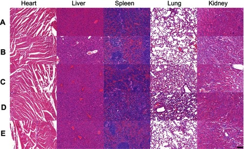 Figure 7 H&E staining of the heart, liver, spleen, lung, and kidney of the mice after the 21-day treatment of (A) saline, (B) Au PENPs, (C) BmK CT-Au PENPs, (D) Au PENPs-131I, and (E) BmK CT-Au PENPs-131I. The scale bar in each panel indicates 200 μm.Abbreviations: BmK CT, Buthus martensii Karsch chlorotoxin; BmK CT-Au PENPs, BmK CT modified polyethylenimine-entrapped gold nanoparticles; Au PENPs, polyethylenimine-entrapped gold nanoparticles; BmK CT-Au PENPs-131I, 131I-labeled BmK CT modified polyethylenimine-entrapped gold nanoparticles; Au PENPs-131I, 131I-labeled polyethylenimine-entrapped gold nanoparticles.