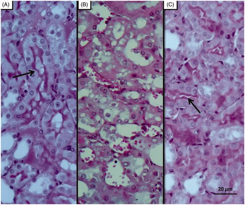 Figure 7. PAS staining results; Histopathology showing loss of brushy margins in proximal tubules in the I/R group (B). Regular appearance of brushy margins (arrow) in the Sham (A) and desloratadine-treated groups (C).