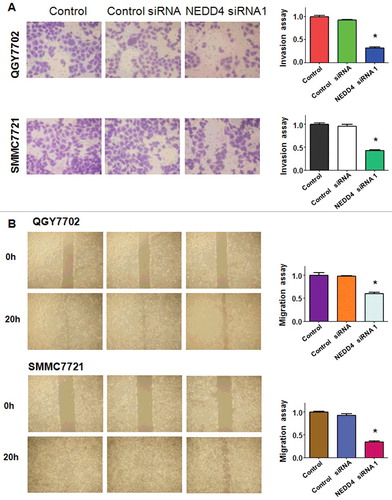 Figure 3. Knockdown of NEDD4 inhibited cell migration and invasion in liver cancer cells. A. Left panel: Invasion assay was conducted to measure the invasive capacity of liver cancer cells after NEDD4 depletion. Right panel: Quantitative results are illustrated for panel A. B. Left panel: Wound healing assays were used to detect the motility in liver cancer cells after NEDD4 depletion. Right panel: Quantitative results are illustrated for panel B. * P<0.05 vs control.