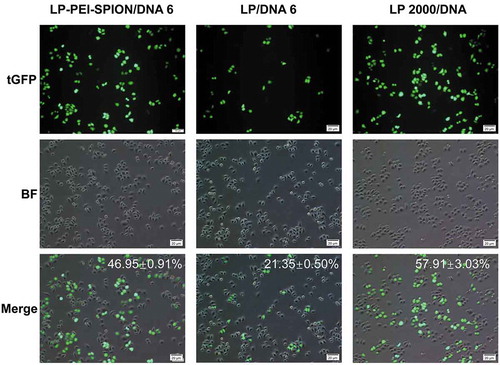 Figure 6. Cell morphology after transfection with LP-PEI-SPION/DNA 6, LP/DNA 6 and LP 2000/DNA.LP-PEI-SPION/pEGFP-N2 complexes at weight ratio 6 were transfected into SPC-A1 cells. LP and Lipofectamine® 2000 were used as controls. The transfection efficiency (%) was defined as (Number of EGFP positive cells/Number of total cells) × 100%.