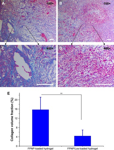 Figure 6 Representative images of Masson’s trichrome staining of 4T1 tumor from (A and C) the FPNP-loaded hydrogel group and (B and D) FPNP/Los-loaded hydrogel group after treatment. (E) Quantification of Masson trichrome-stained collagen expression with ImageJ (n=6, mean ± SD).Notes: The histopathological analysis was carried out at 100× and 400× magnification. Blue staining indicates collagen expression. Scale bar represents 100 µm. **P<0.01.Abbreviations: FPNPs, fluorescent polystyrene nanoparticles; Los, losartan.